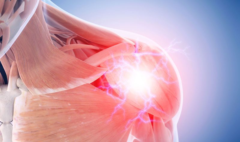 Shoulder pain – causes and treatment